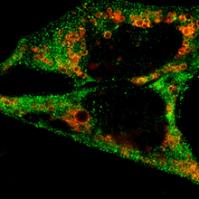 Two cells fluorescently stained for normal (red) and damaged (green) lysosomes.