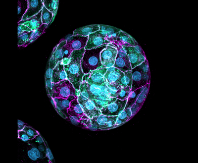 A developing embryo with DNA labeled blue, cell boundaries labeled pink, and certain cells fluorescing green.