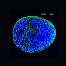 A microscopy image of an apical-out colon organoid that was produced using MilliporeSigma&rsquo;s protocol.