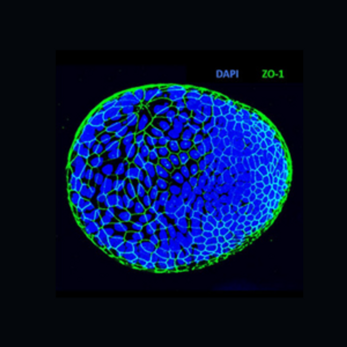 A microscopy image of an apical-out colon organoid that was produced using MilliporeSigma’s protocol.